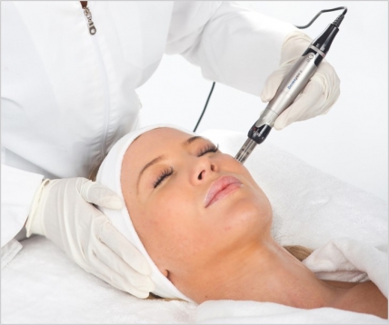 Dermapen Treatment Image_1.jpg