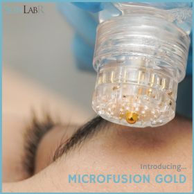 Microfusion Gold