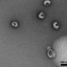 EM photo of exosomes